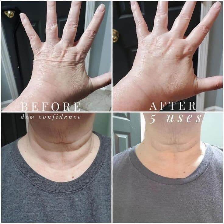 LimeLife Dew Confidence Before and After